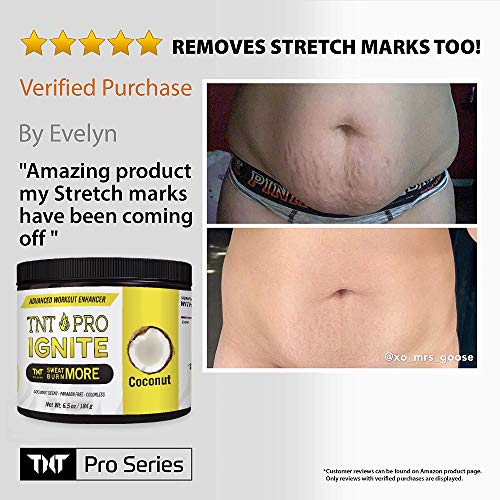 Slimming Cream For Belly With Coconut Oil - Tnt Pro Ignite Sweat